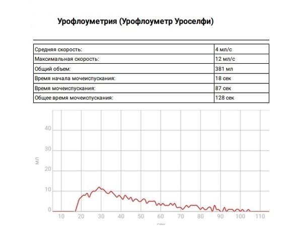 Показатели урофлоуметрии до лечения