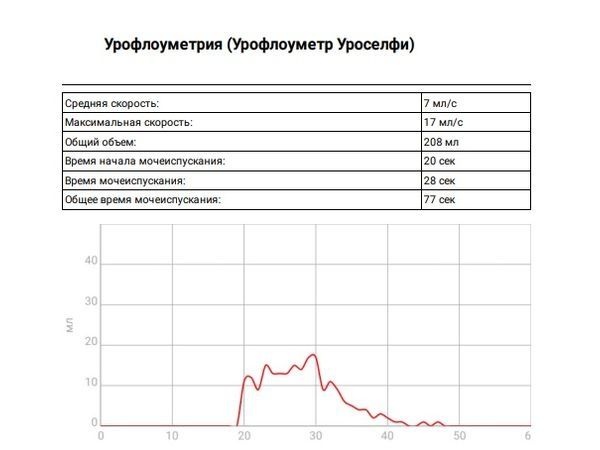 Показатели урофлоуметрии после лечения
