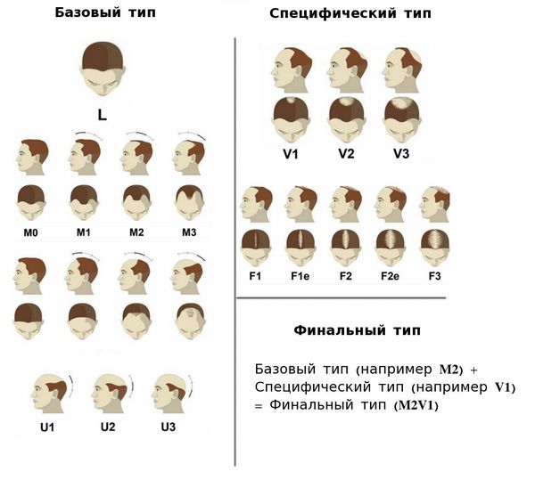 Классификация BASP 