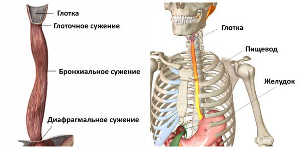 Области сужений
