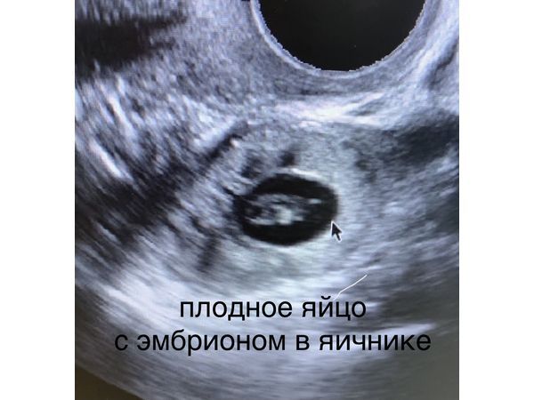 Картинка УЗИ