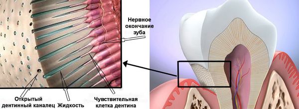 Дентинные канальцы зуба
