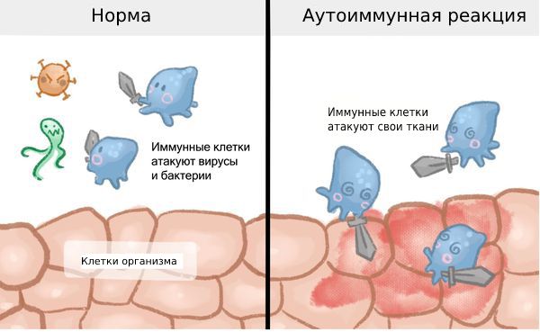 Аутоиммунная реакция