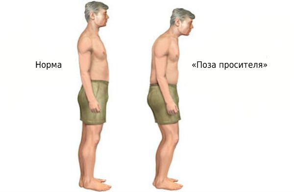 «Поза просителя»