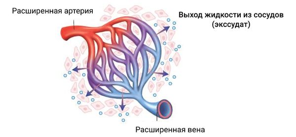 Расширение сосудов