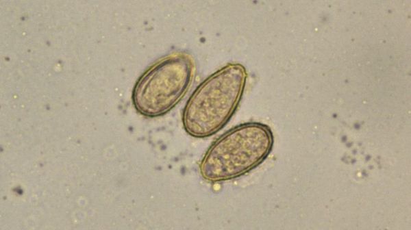 Яйца Opisthorchis felineus