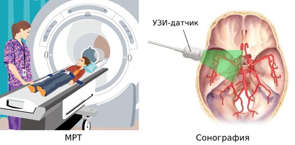 МРТ и сонография