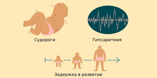 Проявления синдрома Веста